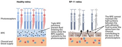 Figure 1. Structure of the retina and changes in RP-11 patients
Image created using Biorender.com