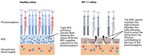 PYC's Lead Investigational Drug, VP-001, Demonstrates Another Key Functional Improvement in Patient-Derived Models - A First for Any RP11 Treatment To-Date