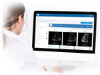 SonoSim AI Powered Automated Assessment Removes a Major Barrier to Ultrasound Adoption