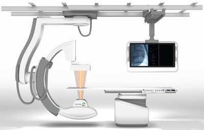Driven by an intuitive tablet interface, ControlRad Select optimizes the X-ray beam and image quality to reduce radiation by 85%