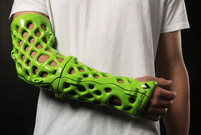 St. Luke's offers a new kind of cast from ActivArmor.