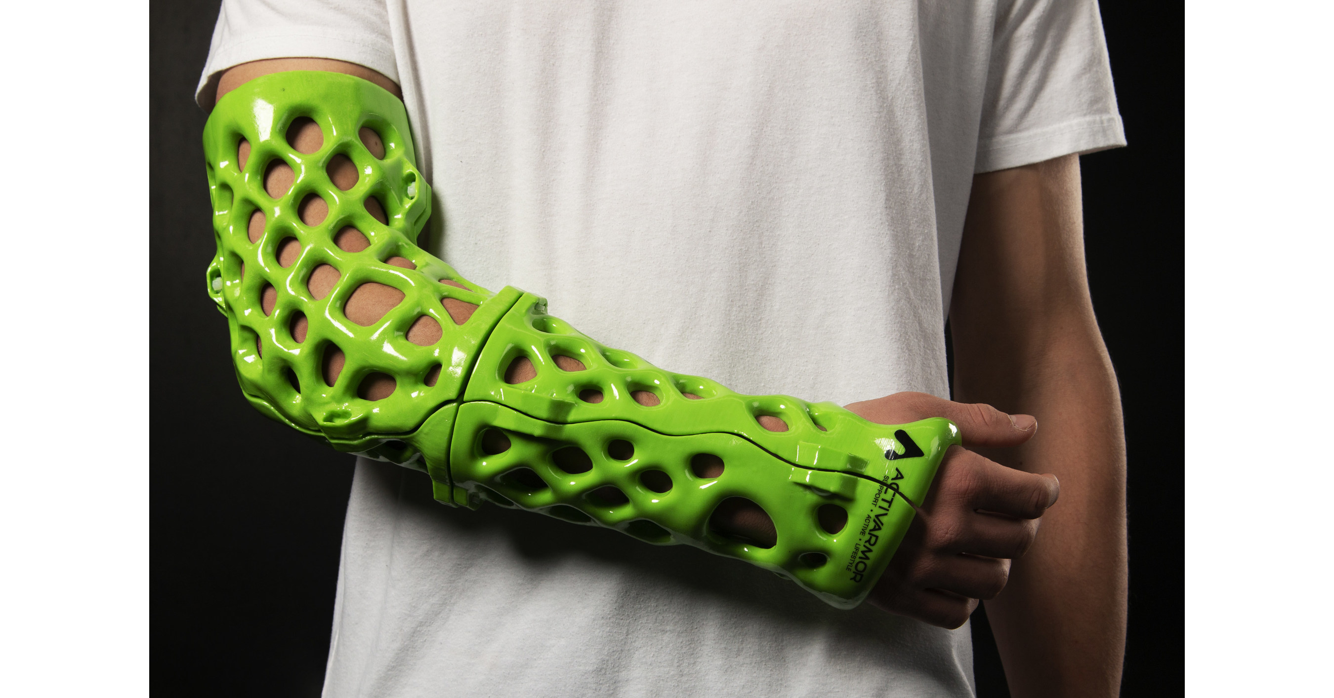 new-3d-printed-orthopedic-casts