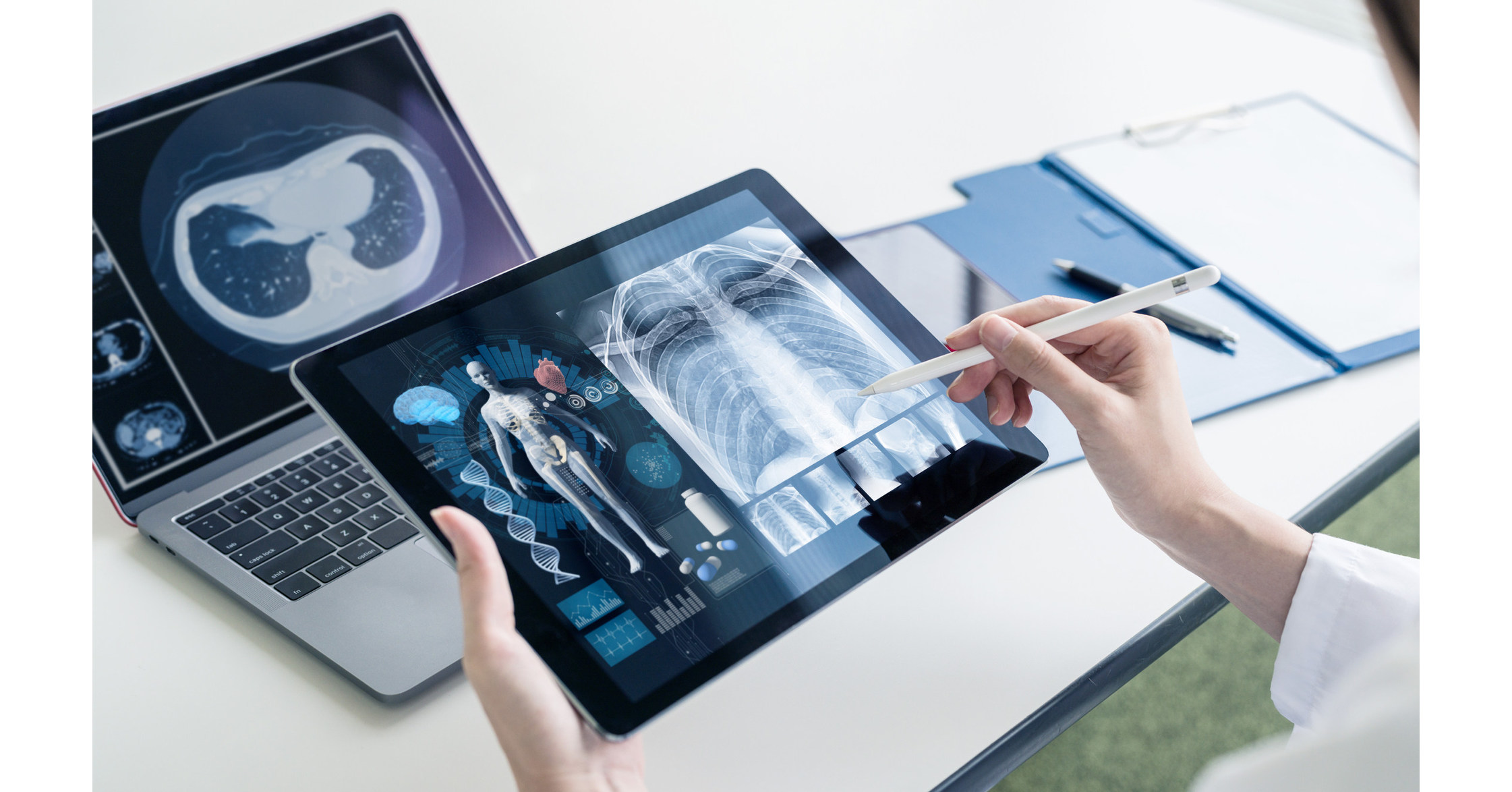 Global Medical Imaging Informatics Market Accelerated by Cloud and AI