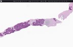Epredia And Paige Announce Global Commercial Distribution Agreement For Digital Pathology Software