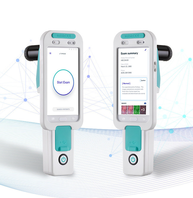 MobileODT EVA VisualCheck AI Technology for Cervical Cancer Screening (PRNewsfoto/MobileODT)
