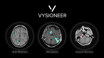 ClearPoint Neuro Announces FDA Clearance and First-in-Human Cases Performed  with the New 2.2 Software Version and the Integrated Maestro Brain Model