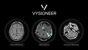 Vysioneer Receives FDA Clearance on First-Ever Tumor Auto-Contouring Solution for Radiation Therapy