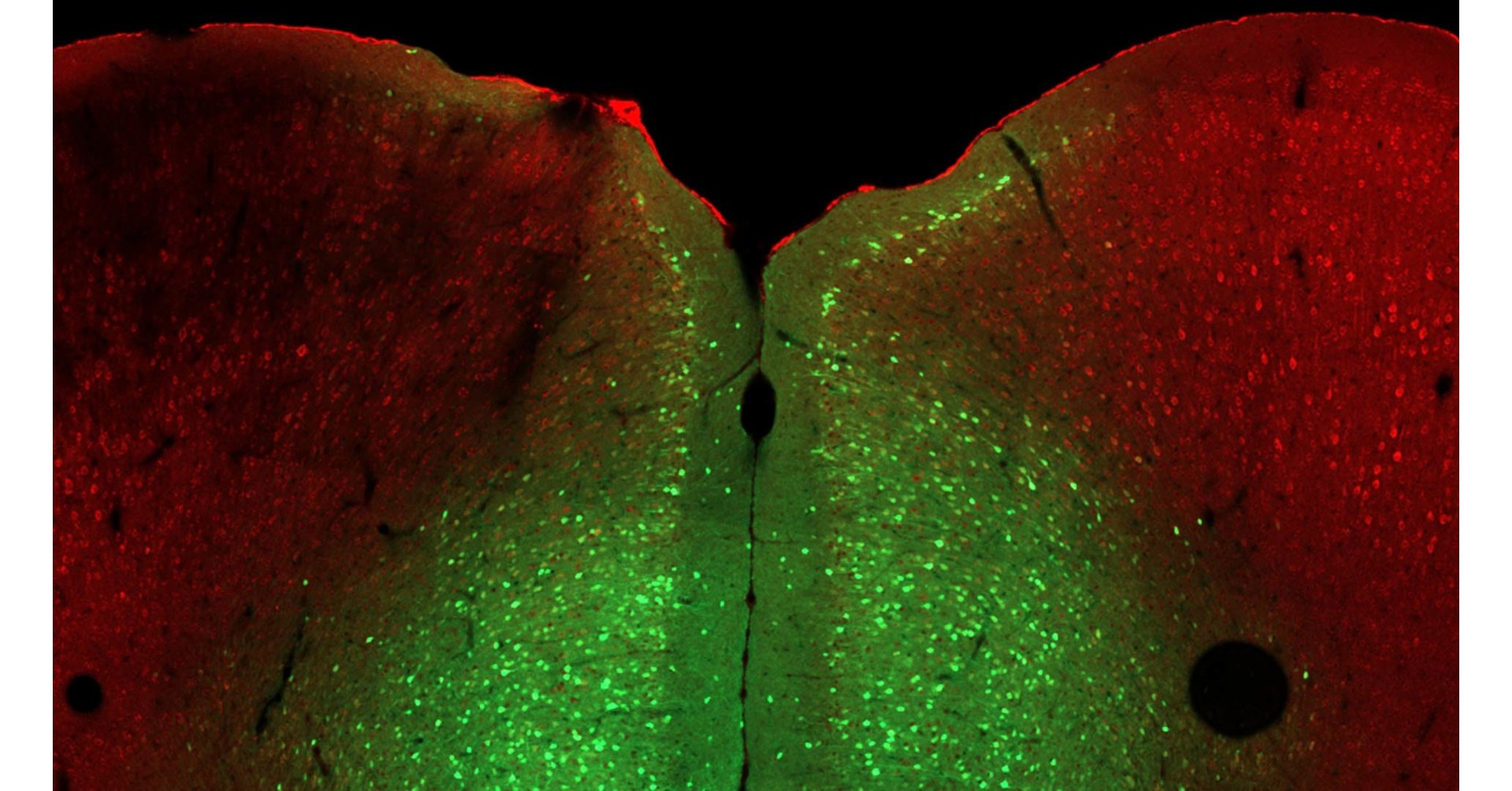 Reversing a genetic cause of poor stress responses in mice - Vimarsana News