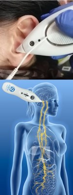Health Canada approves 1st medical device to treat acute COVID-19 respiratory failure.  Science = Truth. Let the truth be heard that the COVID-19 ICU crisis does have a safe and effective solution at hand (CNW Group/Dolphin Neurostim)