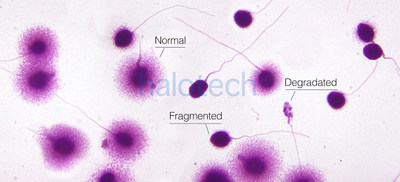 Legacy Sperm DNA Fragmentation