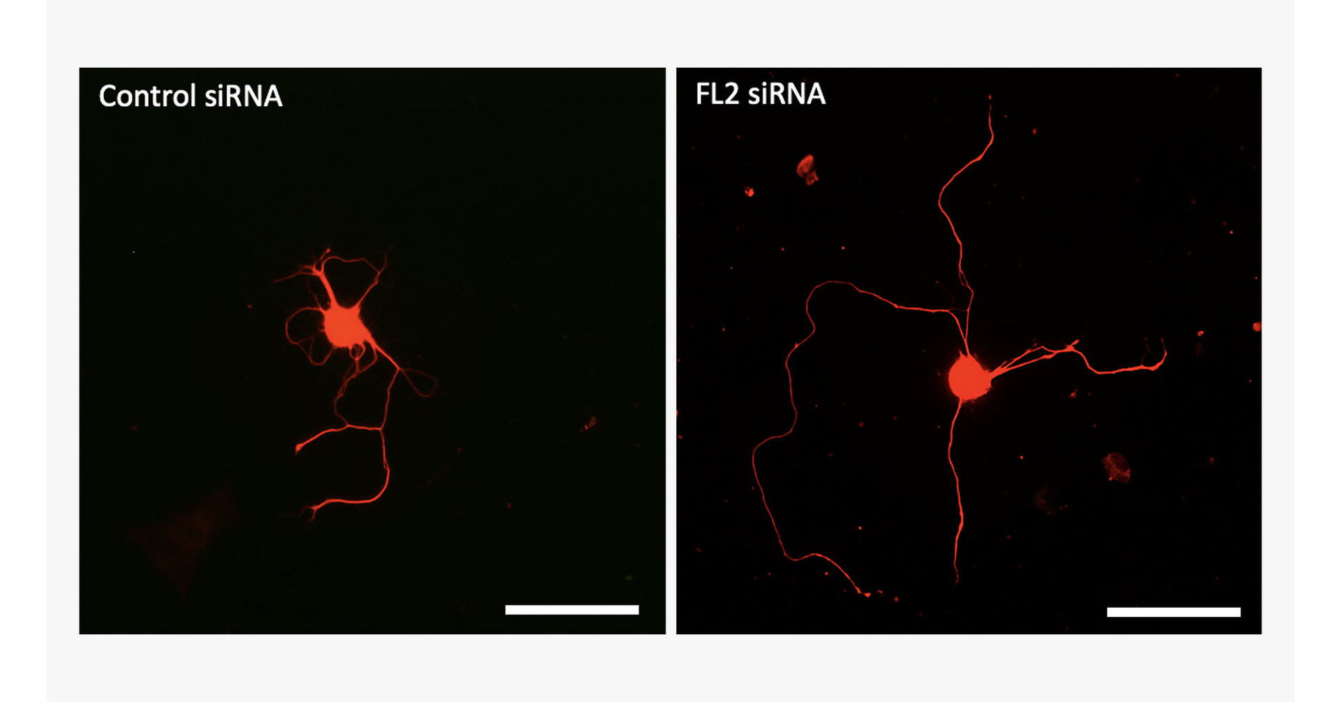 New drugs regenerate erectile nerves that are damaged by