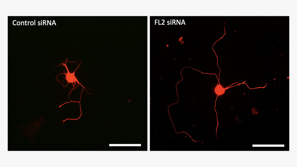 Novel Drug Regenerates Erectile Nerves Damaged by Prostate