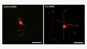 Novel Drug Regenerates Erectile Nerves Damaged by Prostate Surgery