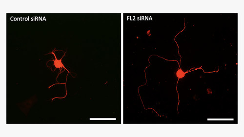 These images show neurons cultured in petri dishes and treated with either control (inactive) siRNA (left) or the siRNA drug itself (FL2 siRNA) (right). Neurons treated with the drug regenerate their axons (the thin fibers extending from the neurons' central bodies) at a significantly faster rate than control-treated neurons. Scale bar = 0.10 mm.