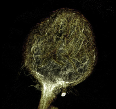iDISCO optically cleared whole mouse bladder, acquired at 8192x8192 pixels using a 2x Plan Apo objective lens, effective pixel size 0.6um (over 10x the spatial resolution of a typical monochrome CMOS camera). Courtesy of Dr. Gerry Apodaca, Integrative Systems Biology, Department of Medicine, University of Pittsburgh. In collaboration with Dr. Alan Watson at the Center for Biological Imaging, University of Pittsburgh.