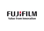 Fujifilm svela il portafoglio di soluzioni pneumologiche ampliate con l'aggiunta di un nuova dotazione