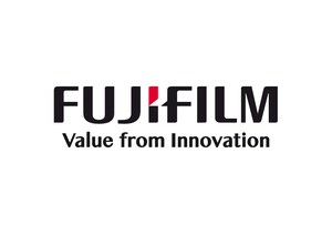 Fujifilm Europe führt neue virtuelle Messlösung ein, um die Herausforderungen zu bewältigen, denen Endoskopiker bei der Messung von Polypen gegenüberstehen