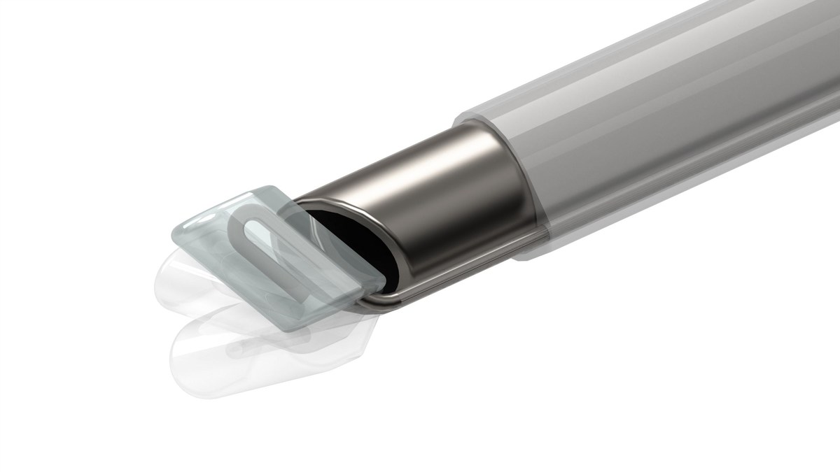 ClearCam Success in First 100 Human Trials with Kelling™ Device - Vimarsana News
