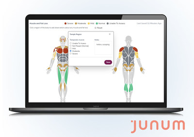 Junum's MalnutritionCDS solution is now available on Epic's App Orchard.