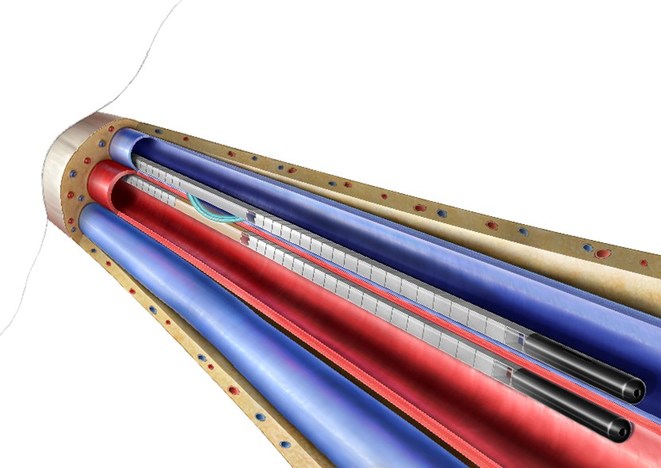 BD Announces Enrollment in Post-Market Studies of the WavelinQ™ Arteriovenous Endovascular Fistula - Vimarsana News