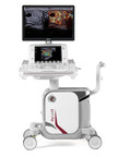 Esaote presenta el sistema de ultrasonido MyLab™X9