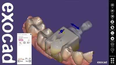 exocad supports the joint dentistry event exocad supports the joint dentistry event