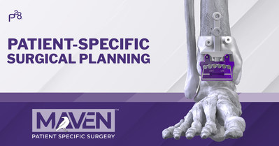 MAVEN™ Patient-Specific Surgical Planning