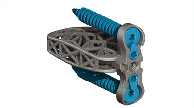 4WEB Medical Announces Commercial Launch of its Lumbar Spine