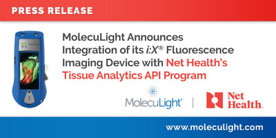 MolecuLight Announces Integration of its i:X® Fluorescence Imaging Device 
with Net Health’s Tissue Analytics API Program (CNW Group/MolecuLight)