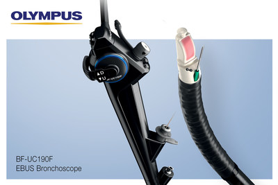 The BF-UC190F EBUS Bronchoscope is the newest addition to the robust Olympus EBUS portfolio of devices for the minimally invasive diagnosis and staging of lung cancer.