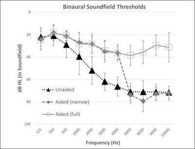 Average Binaural Detection Thresholds for Frequency-Modulated Tones in Sound Field for All Participants (N¼15). Error bars indicated one standard deviation from the mean. Conditions include unaided listening versus listening with the direct drive hearing aid, programmed either with settings for use in a trial period (full bandwidth) or with narrow bandwidth test condition with gain restricted above 5000 Hz.