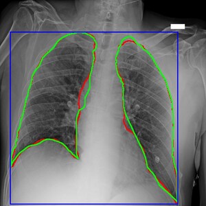 AI-for-COVID19: Predictive Diagnostics Platform Available to Global Scientific Community