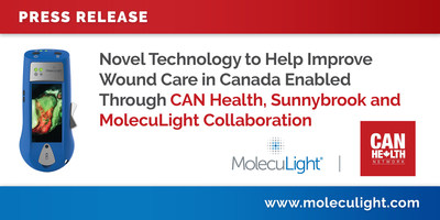 Novel Technology to Help Improve Wound Care in Canada Enabled Through CAN Health, 
Sunnybrook and MolecuLight Collaboration (CNW Group/MolecuLight)