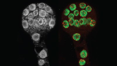 Plants use chemical, or epigenetic, modifications to control the activity of their genes. Red and green mark epigenetic modifications in the DNA (gray on the left) of an early embryo of an Arabidopsis thaliana plant. Cold Spring Harbor Laboratory Professor & HHMI Investigator Rob Martienssen’s team discovered one of the genes responsible for attaching these modifications at the right spots in the genome. Image: Daniel Grimanelli and Jean-Sébastien Parent/Martienssen lab, CSHL/2021