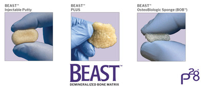 Paragon 28 BEAST™ Injectable, BEAST™ Plus, and BEAST™ Osteobiologic Sponge (BOB™)