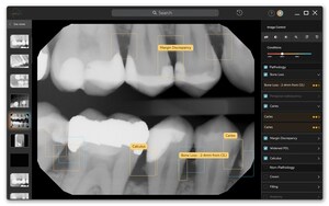 Pearl Receives Industry-First Regulatory Certification for Comprehensive Dental Pathology Detection in European Markets