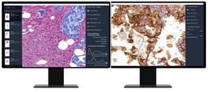 AI-based Analysis of Cancer Tissue Predicts Response to Immunotherapy--Findings to Be Presented at ASCO 2021