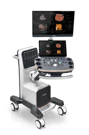 Inspirando a área de cuidados de saúde da mulher: Mindray lança Nuewa I9, novo sistema de ultrassom para diagnóstico ginecológico e obstétrico