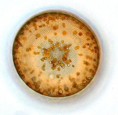 Marine diatom species Coscinodiscus wailesii (light microscope). Credit : Dr. Fengjie LIU, GEOMAR Helmholtz Centre for Ocean Research (CNW Group/Institut National de la recherche scientifique (INRS))