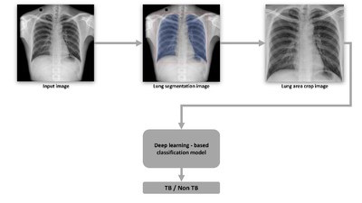 Tuberculosis Classification Approach