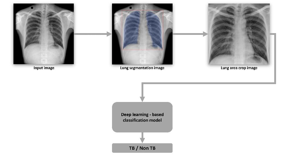 VinBrain and FIT Jointly Release a White Paper on Utilizing Artificial Intelligence in Tuberculosis Screening - Vimarsana News