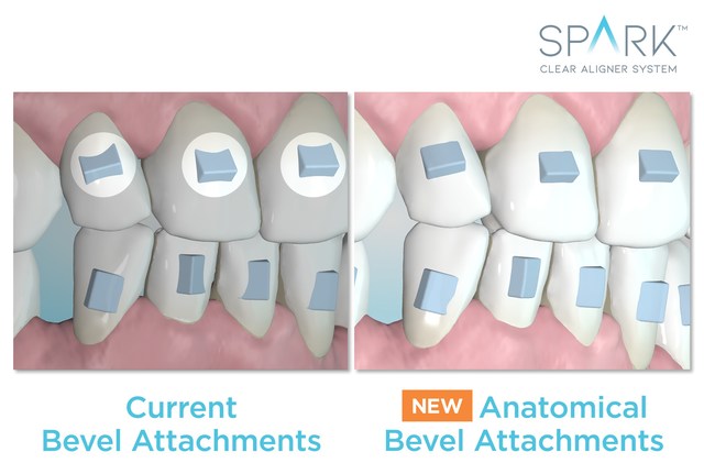 Spark Aligners Does It Again With Market Leading Innovation And New FDA 