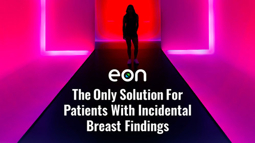 Market Leader Eon Rolls Out A First-Of-Its-Kind Breast Software Solution
