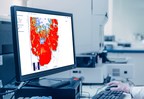 Epredia And Aiforia Announce Partnership For Global Distribution Of AI-powered Pathology Software