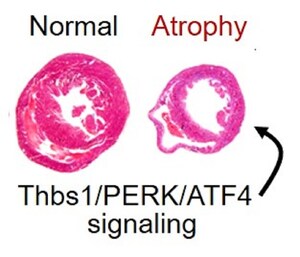 Cardiac Atrophy Findings May Set Course for Preventing Harm from Long Space Flights