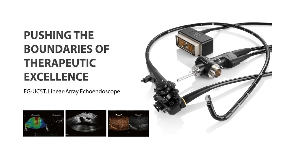 SonoScape erhält CE-Kennzeichnung für sein Linear-Array-Echoendoskop EG-UC5T SonoScape erhält CE-Kennzeichnung für sein Linear-Array-Echoendoskop EG-UC5T
