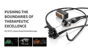 SonoScape obtient le marquage CE pour son échoendoscope linéaire EG-UC5T