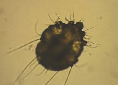 Scabies Mite (Sarcoptes scabiei var. hominis)