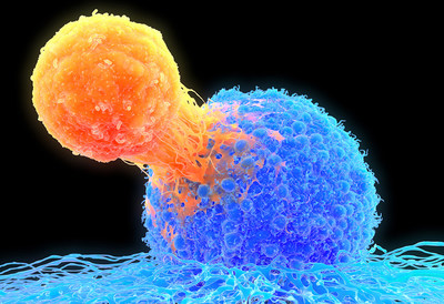 T-cell attaching to cancer cell, illustration T lymphocyte (orange) attached to a cancer cell (blue), illustration. T lymphocytes are a type of white blood cell which matures in the thymus. Certain kinds of T lymphocytes can recognise specific sites (antigens) on the surface of cancer cells or pathogens and bind to them. They can then destroy the cancer cells, or signal for other immune system cells to eliminate them. The genetic changes that cause a cell to become cancerous lead to the present