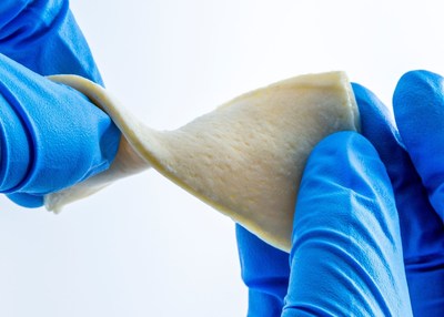 AlloSource introduces new AlloMend Ultra-Thick Acellular Dermal Matrix allograft